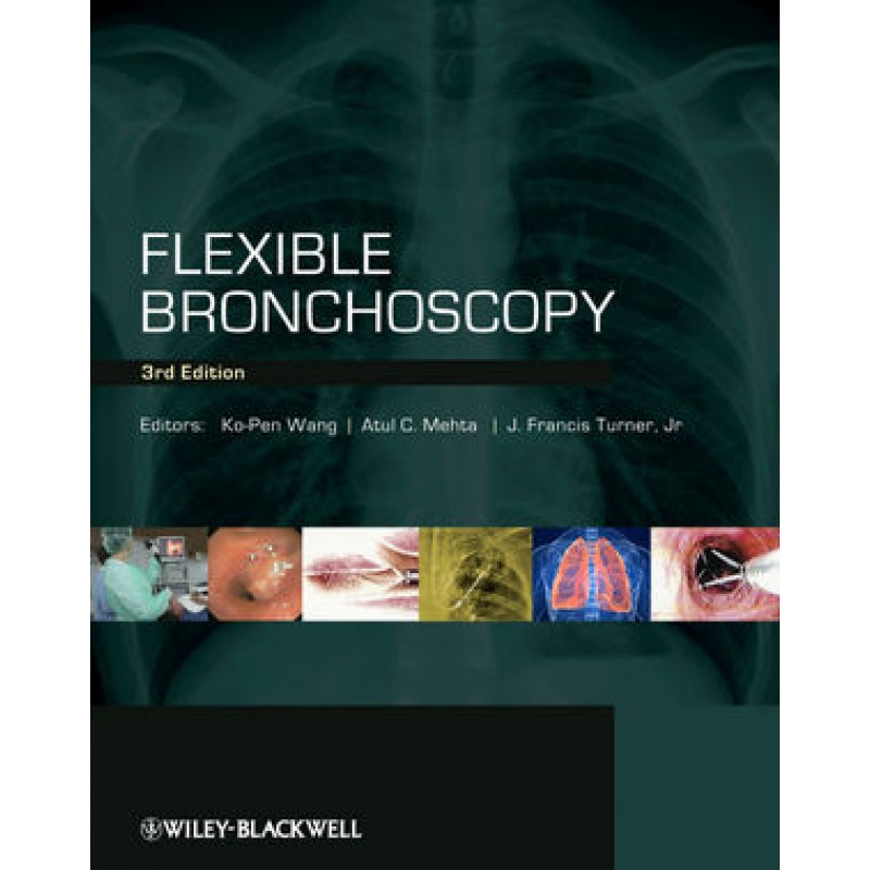 Flexible Bronchoscopy, 3rd Edition